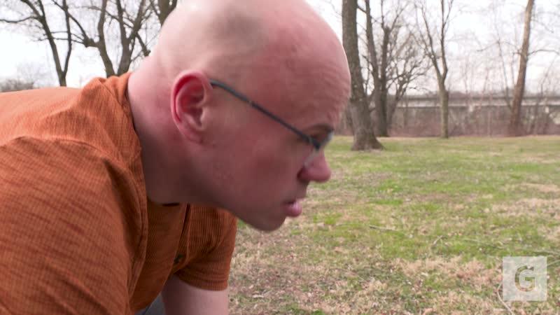 We re-visit Chris years after his surgery and incredible weight loss!