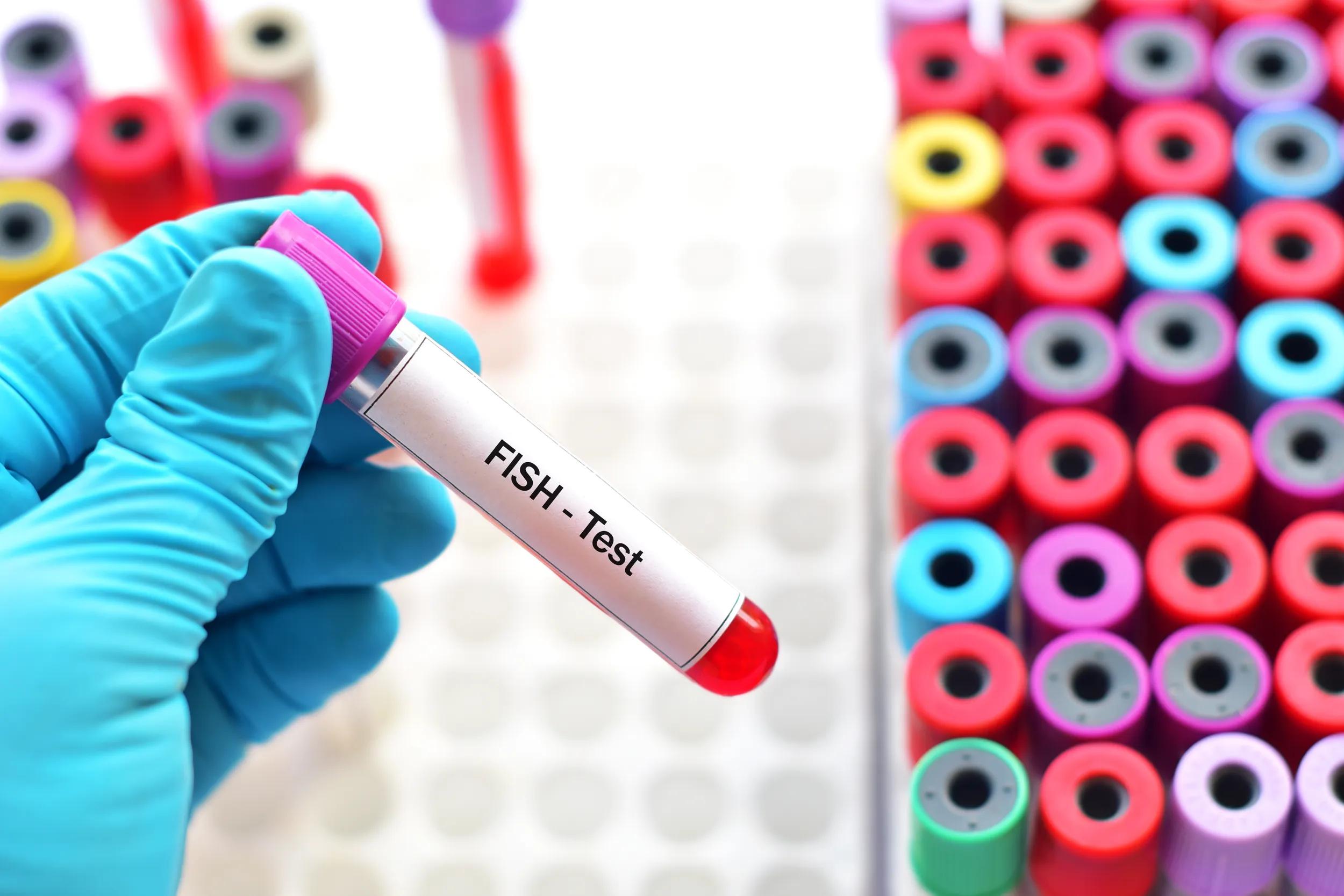 Blood sample for FISH test