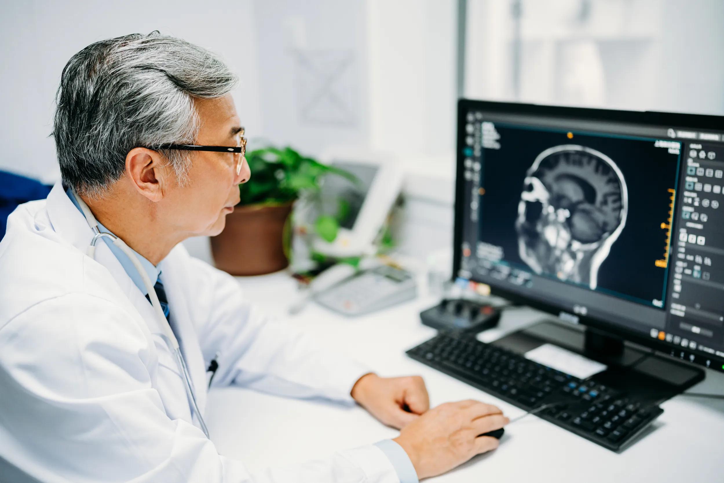 Asian senior male doctor is reading a CT scan at hospital.