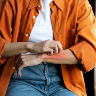 Women's hands with skin inflammation. Cropped view of a female scratching skin
