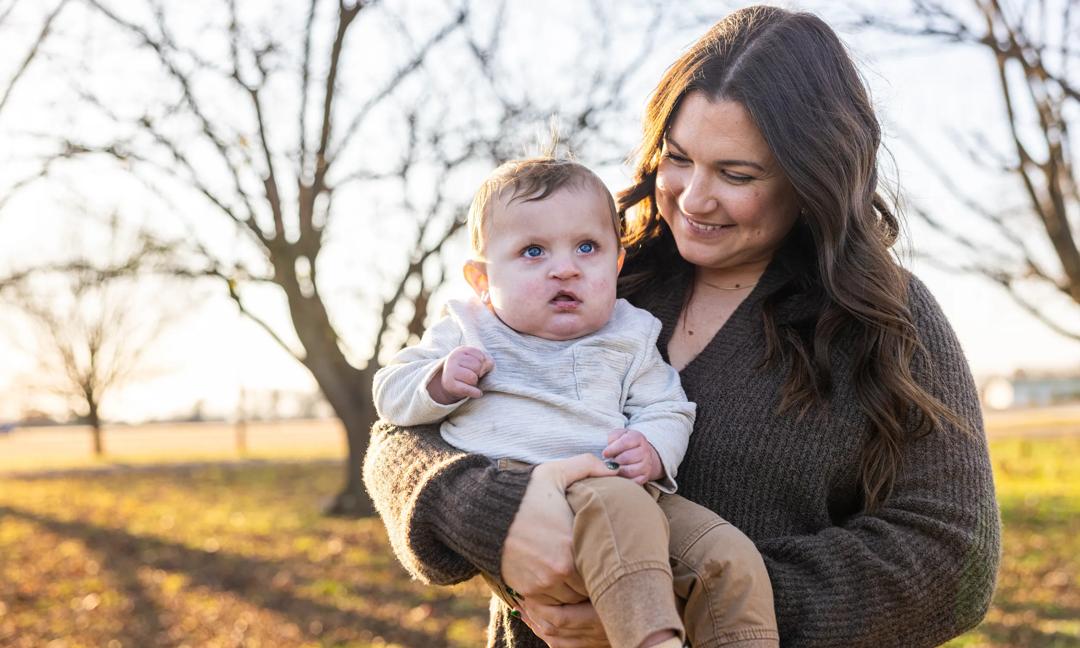 Mother holding her son who has a cleft lip