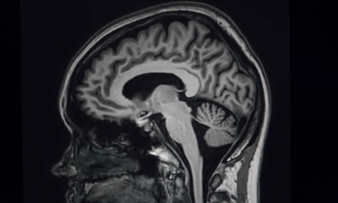 Magnetic resonance imaging (MRI) of the human brain in lateral projections in T1 mode.