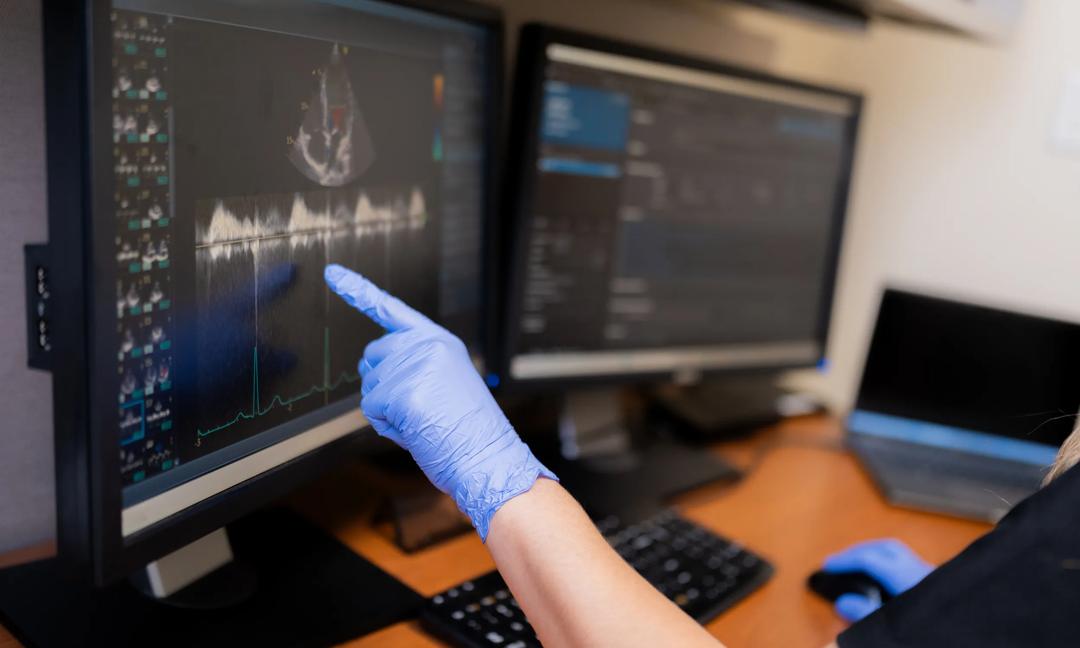Doctor analyzing echocardiogram results on computer monitor