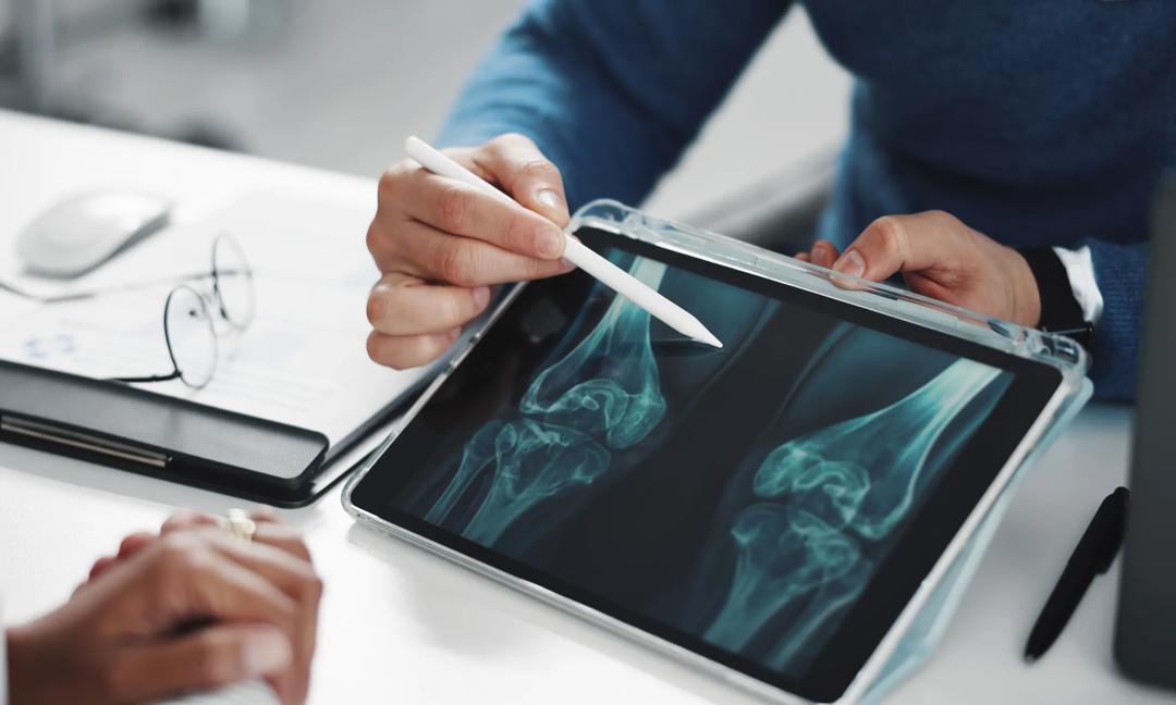 Doctor, patient and hands on tablet screen for knee x ray with injury, osteoporosis or tendon issue. People, pointing and talking in medical consultation for arthritis, feedback and clinic report